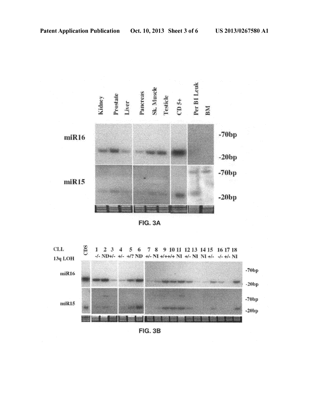 Compositions and Methods for the Diagnosis and Therapy of BCL2-Associated     Cancers - diagram, schematic, and image 04