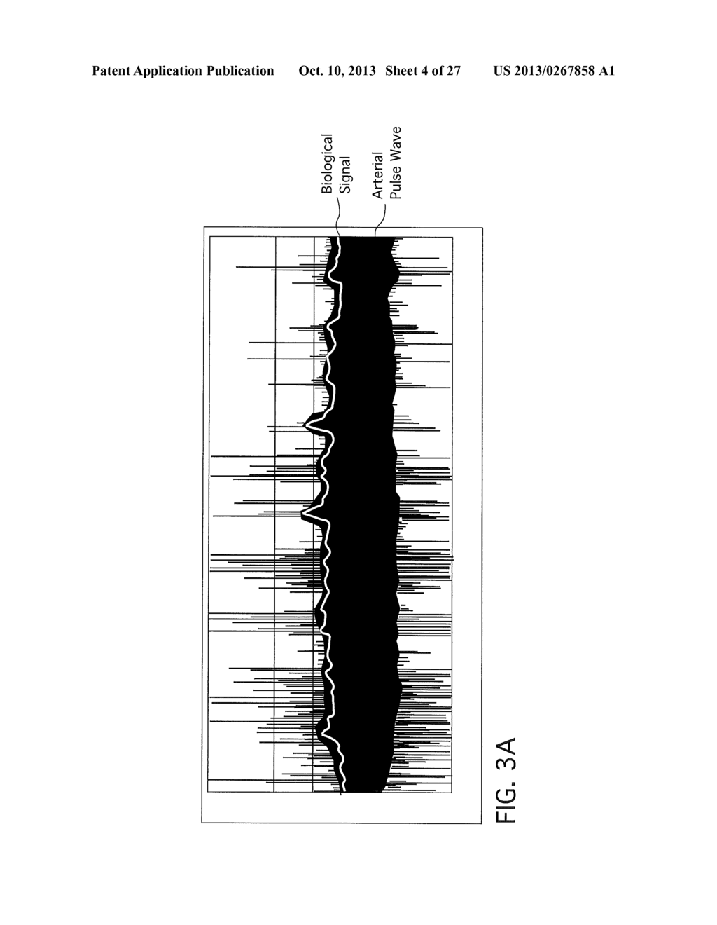 SYSTEM AND METHOD FOR CHARACTERIZING CIRCULATORY BLOOD FLOW - diagram, schematic, and image 05