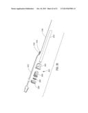 IN-JOINT SENSOR FOR A SURGICAL FLUID MANAGEMENT PUMP SYSTEM diagram and image