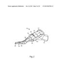 BLADE ANCHOR FOR FOOT AND ANKLE diagram and image