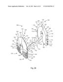 BLADE ANCHOR FOR FOOT AND ANKLE diagram and image