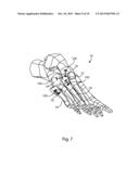 BLADE ANCHOR FOR FOOT AND ANKLE diagram and image