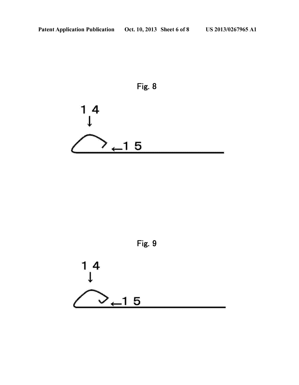 LIGATOR AND LIGATION METHOD - diagram, schematic, and image 07