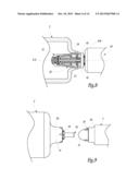 Surgical Treatment System and Method for Performing an Anastomosis Between     Two Hollow Ducts in a Patient, in Particular Between the Bladder and the     Urethra diagram and image