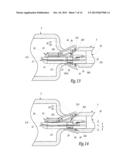 Surgical Treatment System and Method for Performing an Anastomosis Between     Two Hollow Ducts in a Patient, in Particular Between the Bladder and the     Urethra diagram and image