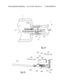 Surgical Treatment System and Method for Performing an Anastomosis Between     Two Hollow Ducts in a Patient, in Particular Between the Bladder and the     Urethra diagram and image