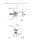 Surgical Treatment System and Method for Performing an Anastomosis Between     Two Hollow Ducts in a Patient, in Particular Between the Bladder and the     Urethra diagram and image