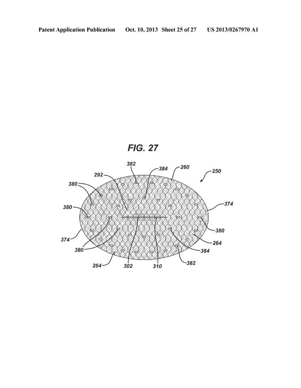 SINGLE PLANE TISSUE REPAIR PATCH - diagram, schematic, and image 26