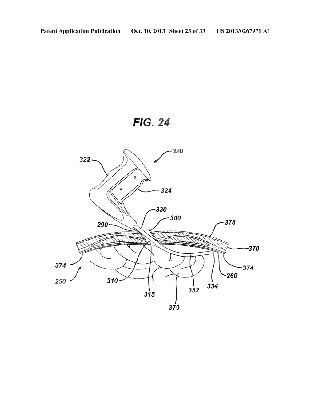 SINGLE PLANE TISSUE REPAIR PATCH - diagram, schematic, and image 24