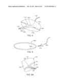 METHODS AND DEVICES FOR DEPLOYING AND RELEASING A TEMPORARY IMPLANT WITHIN     THE BODY diagram and image