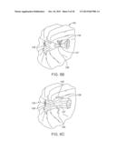 METHODS AND DEVICES FOR DEPLOYING AND RELEASING A TEMPORARY IMPLANT WITHIN     THE BODY diagram and image