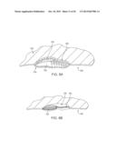 METHODS AND DEVICES FOR DEPLOYING AND RELEASING A TEMPORARY IMPLANT WITHIN     THE BODY diagram and image