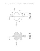 OVER-THE-WIRE EXCLUSION DEVICE AND SYSTEM FOR DELIVERY diagram and image