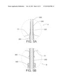 OVER-THE-WIRE EXCLUSION DEVICE AND SYSTEM FOR DELIVERY diagram and image