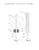 OVER-THE-WIRE EXCLUSION DEVICE AND SYSTEM FOR DELIVERY diagram and image