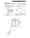 Devices and Methods for Dilating a Paranasal Sinus Opening and for     Treating Sinusitis diagram and image