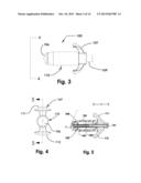 Devices and Methods for Dilating a Paranasal Sinus Opening and for     Treating Sinusitis diagram and image