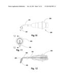 Devices and Methods for Dilating a Paranasal Sinus Opening and for     Treating Sinusitis diagram and image