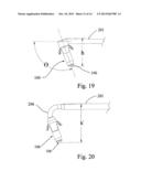 Devices and Methods for Dilating a Paranasal Sinus Opening and for     Treating Sinusitis diagram and image