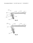 Devices and Methods for Dilating a Paranasal Sinus Opening and for     Treating Sinusitis diagram and image