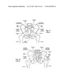 TISSUE DILATOR AND PROTECTOR diagram and image