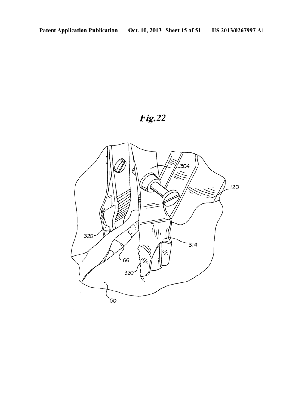 MECHANICAL METHOD AND APPARATUS FOR BILATERAL TISSUE FASTENING - diagram, schematic, and image 16