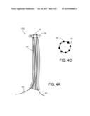 TISSUE GRAFT ANCHORING diagram and image