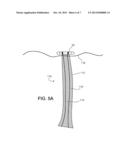 TISSUE GRAFT ANCHORING diagram and image