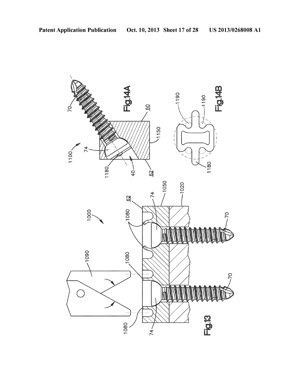 Zero-Profile Interbody Spacer and Coupled Plate Assembly - diagram, schematic, and image 18