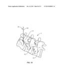 SPINAL CORRECTION SYSTEM AND METHOD diagram and image