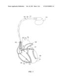 IMPLANTABLE MEDICAL DEVICES, AND METHODS OF USE THEREWITH, THAT DETECT     EXPOSURE TO MAGNETIC FIELDS FROM MRI SYSTEMS diagram and image