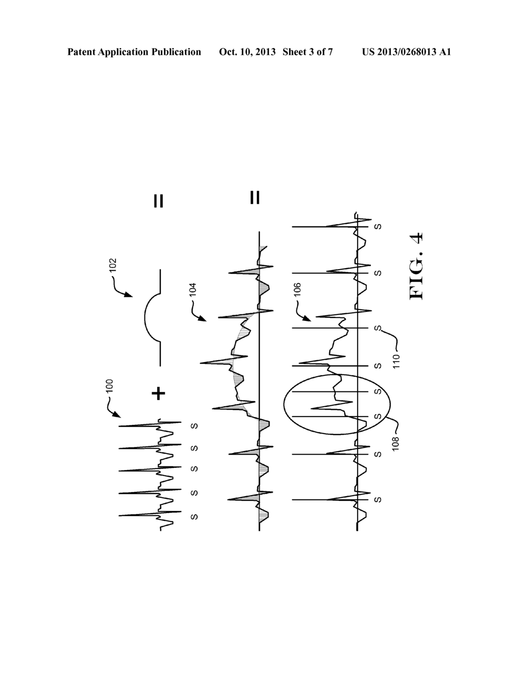 ELECTRODE SPACING IN A SUBCUTANEOUS IMPLANTABLE CARDIAC STIMULUS DEVICE - diagram, schematic, and image 04