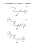 METHOD AND APPARATUS FOR PACING DURING REVASCULARIZATION diagram and image