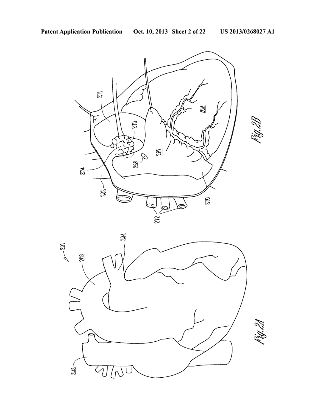 AUTOMATIC BAROREFLEX MODULATION BASED ON CARDIAC ACTIVITY - diagram, schematic, and image 03