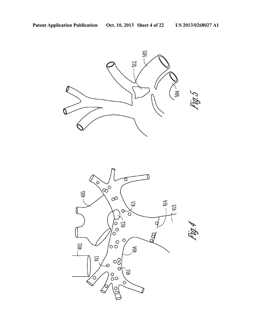 AUTOMATIC BAROREFLEX MODULATION BASED ON CARDIAC ACTIVITY - diagram, schematic, and image 05