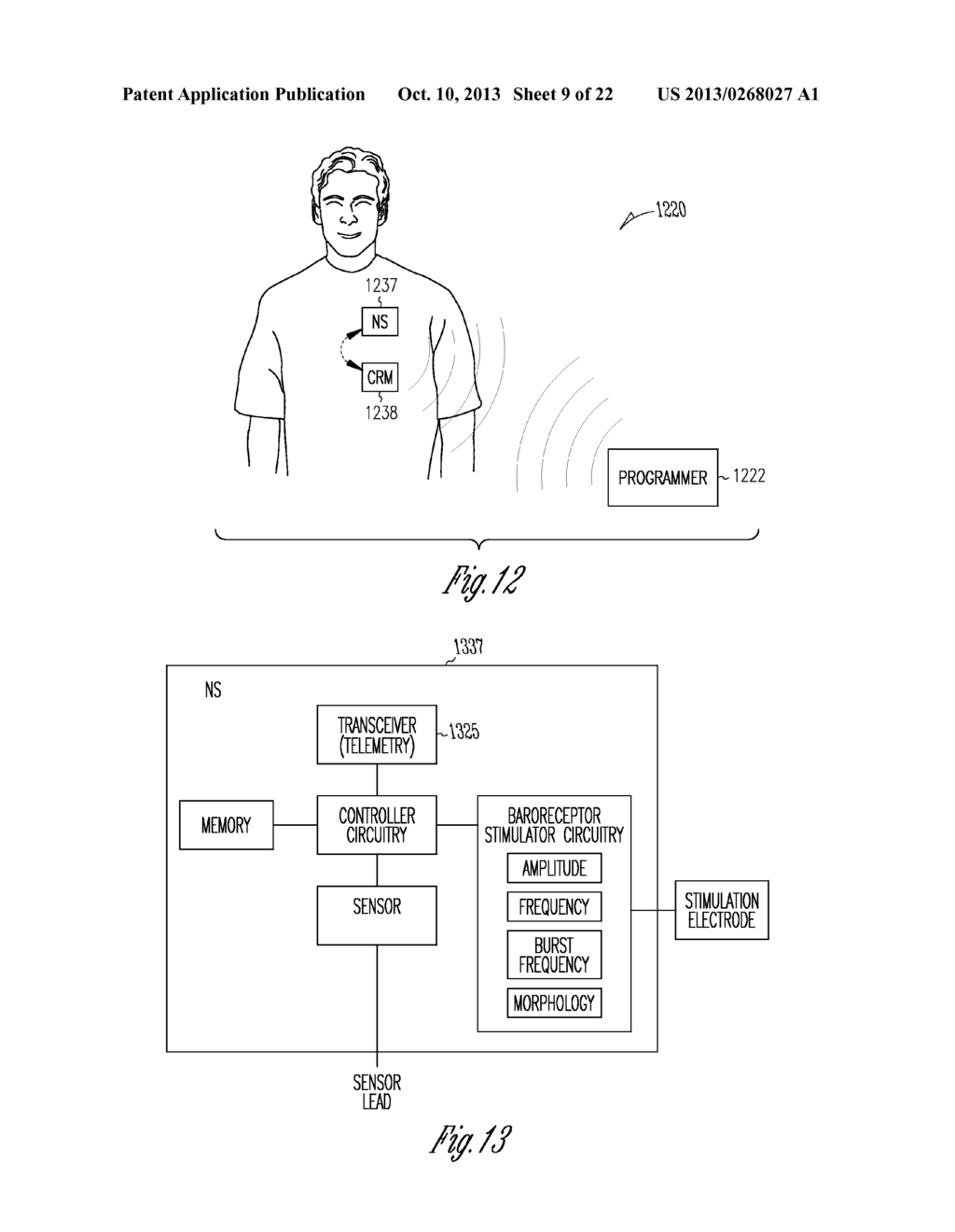 AUTOMATIC BAROREFLEX MODULATION BASED ON CARDIAC ACTIVITY - diagram, schematic, and image 10