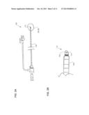 Apparatus and Method of Treating a Vein with Heat Energy diagram and image