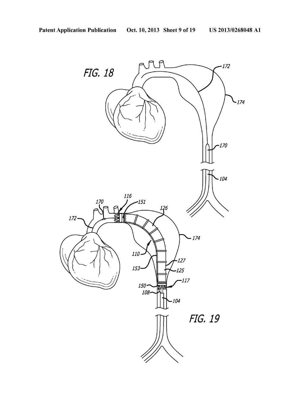 DELIVERY CATHETER FOR ENDOVASCULAR DEVICE - diagram, schematic, and image 10