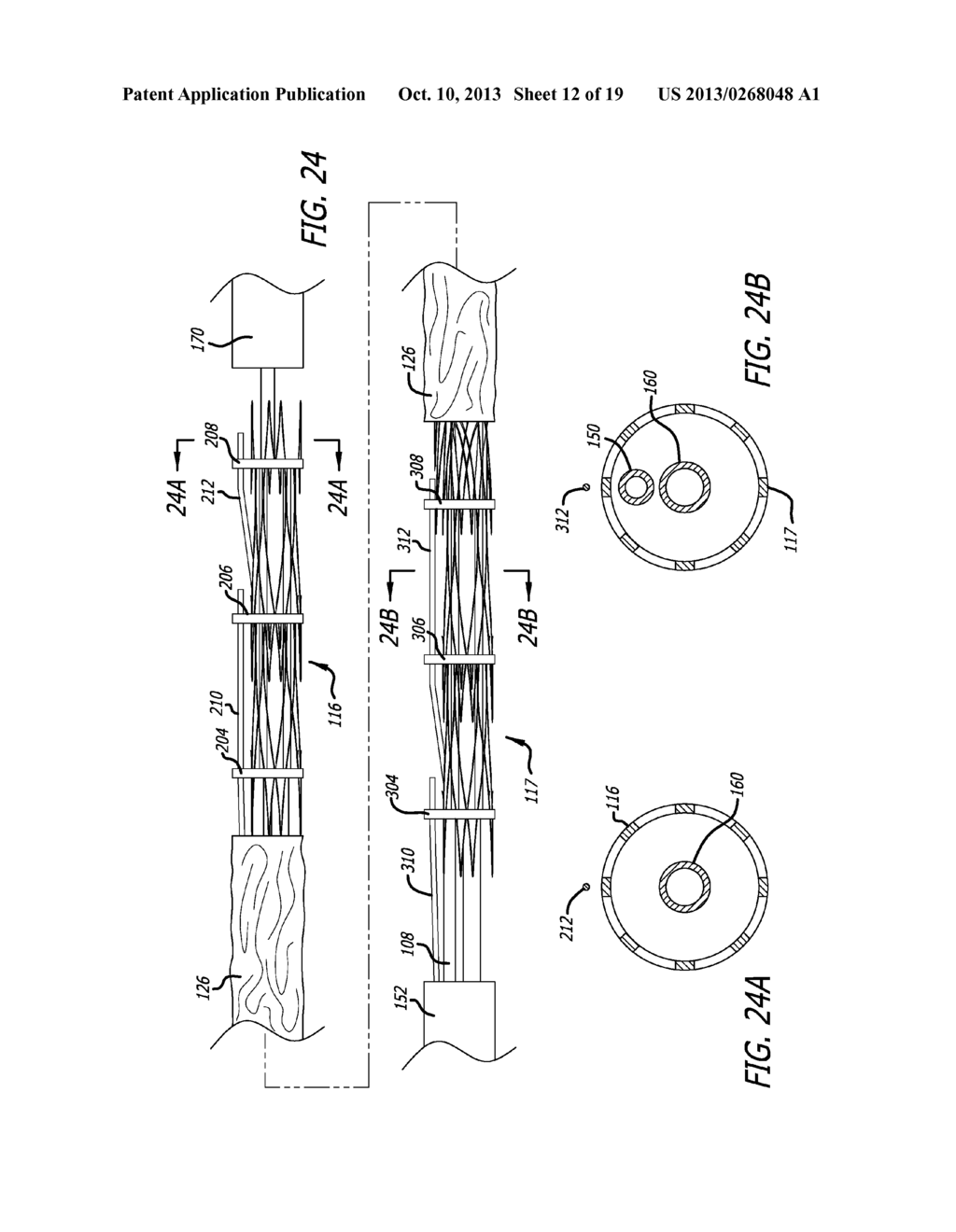 DELIVERY CATHETER FOR ENDOVASCULAR DEVICE - diagram, schematic, and image 13