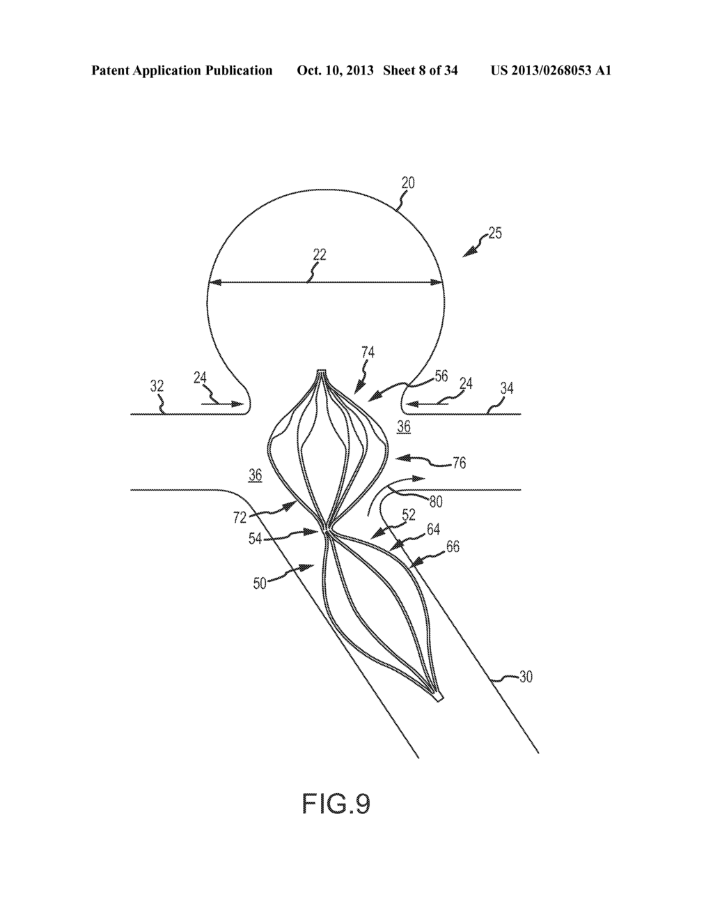 VASCULAR REMODELING DEVICE - diagram, schematic, and image 09