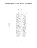 COMPOSITE PROSTHETIC DEVICES diagram and image