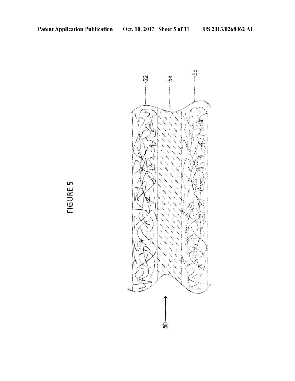 COMPOSITE PROSTHETIC DEVICES - diagram, schematic, and image 06