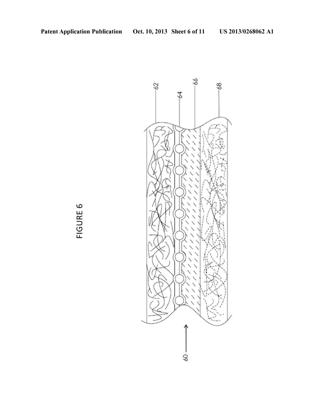 COMPOSITE PROSTHETIC DEVICES - diagram, schematic, and image 07