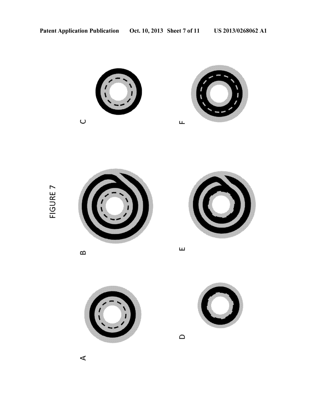 COMPOSITE PROSTHETIC DEVICES - diagram, schematic, and image 08