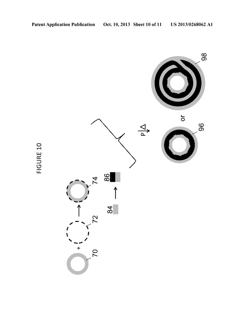 COMPOSITE PROSTHETIC DEVICES - diagram, schematic, and image 11