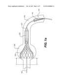 Heart Valve Prosthesis Recapture Devices diagram and image