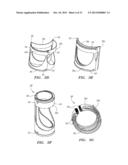 PROSTHETIC HEART VALVES, SCAFFOLDING STRUCTURES, AND SYSTEMS AND METHODS     FOR IMPLANTING OF SAME diagram and image