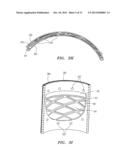 PROSTHETIC HEART VALVES, SCAFFOLDING STRUCTURES, AND SYSTEMS AND METHODS     FOR IMPLANTING OF SAME diagram and image