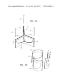 PROSTHETIC HEART VALVES, SCAFFOLDING STRUCTURES, AND SYSTEMS AND METHODS     FOR IMPLANTING OF SAME diagram and image