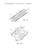 PROSTHETIC HEART VALVES, SCAFFOLDING STRUCTURES, AND SYSTEMS AND METHODS     FOR IMPLANTING OF SAME diagram and image